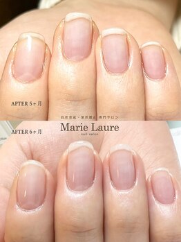 マリーロール 梅田店(Marie Laure)/自爪育成/深爪矯正/ネイルケア