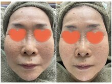 ビーナイス ビューティー(Be Nice Beauty)/