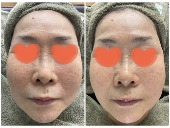 ビーナイス ビューティー(Be Nice Beauty)/