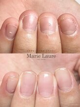 マリーロール 梅田店(Marie Laure)/自爪育成/深爪矯正/ネイルケア