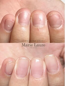マリーロール 梅田店(Marie Laure)/自爪育成/深爪矯正/ネイルケア