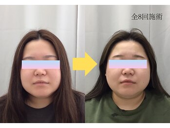 金沢西えみふる整骨院 整体院/小顔/フェイシャル/ヒト幹細胞