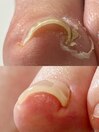 お客様Beforeafter