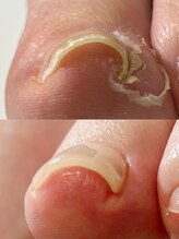 ハッチネイル(HACCI nail)/お客様Beforeafter
