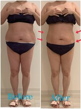 スペチアーレ 夙川/大人気【脂肪冷却】