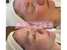 シーデイ(SEA DAY)の雰囲気（多彩なメニューで肌質改善）