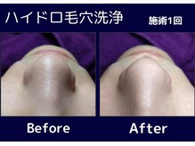 サロン ド プリエ(Salon de Plie)/1回でこの効果！