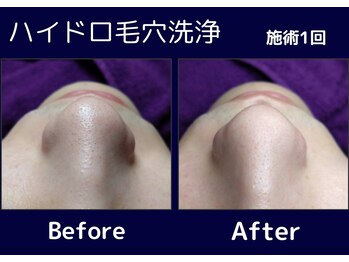 サロン ド プリエ(Salon de Plie)/1回でこの効果!