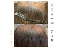 オリエンス(oriens)の雰囲気（毛母細胞の活性サポート★負担をかけない改善方法♪）