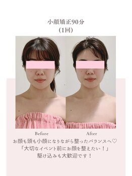 トゥインクル 麻布(twinkle)/南麻布/広尾/白金高輪/小顔矯正