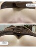 【バストUP！姿勢！背中肉、脇肉、二の腕】お悩みを全解決　90分24200→15600