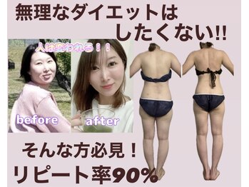 ヨサパーク ルポ(YOSA PARK ropos)