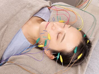 整体 越/美容鍼