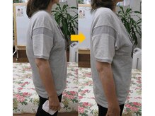 エスコート芦屋サロン/50代　女性　側湾　