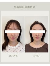マヴィ(mavie)/美顔コースBeforeAfter