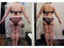 クイーン 札幌駅前店(Queen)/お客様　ビフォーアフター（9）