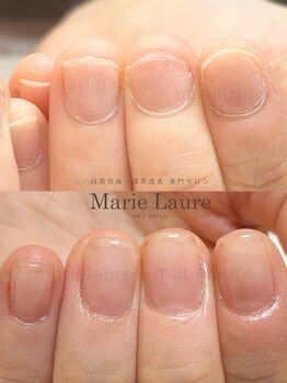 マリーロール 淀屋橋本店(Marie Laure)/自爪育成/深爪矯正/ネイルケア
