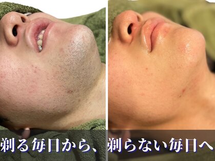 ダブル(DOUBLE)の写真