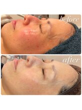 ラディエンス 多治見店/マーメイドセルトリートメント