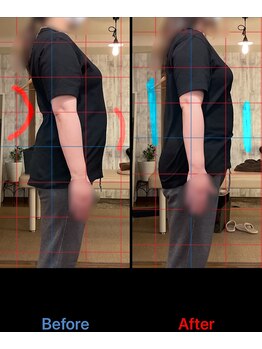 トーラス 整体(TORUS)/反り腰・ぽっこりお腹解消♪