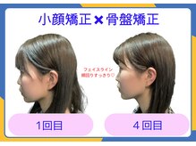 ビオラス 高崎店/骨から整えるのがポイント！