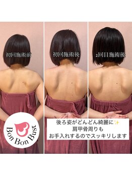 アンベリール(Embellir)/バストケア「ボンボンバスト」