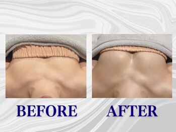 ザモア 福岡天神(THE MORE)/【症例 Before After】