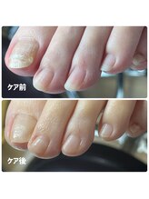 ユキネイル(YUKINAIL)/見違えるほどの、美爪足