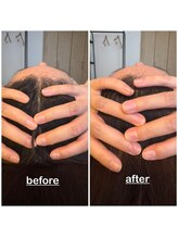 ミニョン(mignon)/頭のケア出来てる？