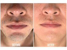 キビック(KIBIK)の雰囲気（男性人気no.1【ヒゲ脱毛】青ヒゲや朝のシェービングいらずの肌へ）