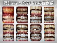 ホワイトニングセンター 浦添市役所前店の雰囲気(最多級事例多数ホワイトニング/那覇市・浦添市ホワイトニング)