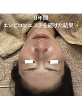 リマイン(Re mine)/長くご愛用されている方のお肌