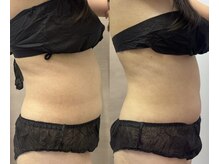 たかやなぎ整体院の雰囲気（ブライダルの方必見！背中、お腹、二の腕の上半身徹底メニュー！）