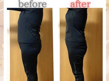 ヨサパーク リリー(YOSA PARK Lily)/