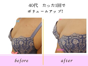 ビーハピネス 京都西院(B-Happiness)/30代　１回でもふっくら