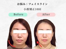 美容整体ウェリナ あま甚目寺院/小顔矯正/骨盤矯正/美脚サロン