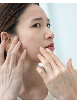 オニュ(onyu)の写真/密かに王道人気の《毛穴ケア》たるみによる毛穴開き、毛穴の詰まり、黒ずみ悩みを改善していきます◎