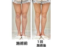 鍼灸サロンオランジュ 高槻富田院/