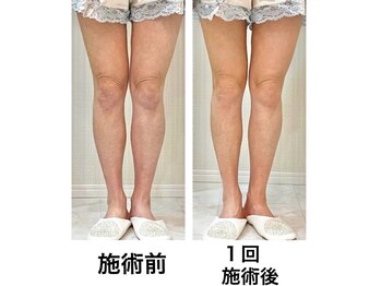 鍼灸サロンオランジュ 高槻富田院/