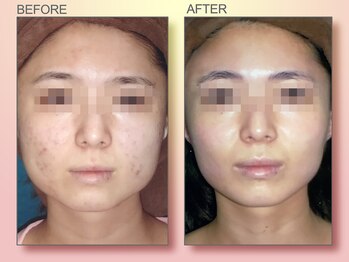 ジュリア オージェ 四条河原町店/ビフォーアフター（ホワイト）