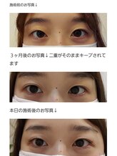 アロマスイーツ(AromaSweets)/まつげパーマ/まつ毛パーマ