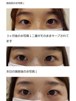 アロマスイーツ(AromaSweets)/まつげパーマ/まつ毛パーマ