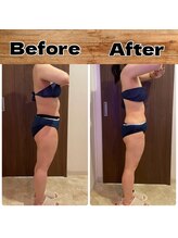 あきくに整骨院 美容整体院/M様ビフォーアフター