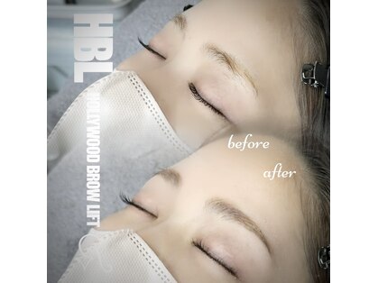 リンネ(Rinne)の写真