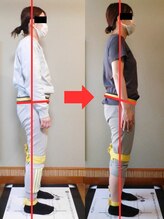 チャラク(charaku)/【30代N様：全身矯正+猫背矯正】