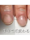 丸い爪から縦に伸びました！