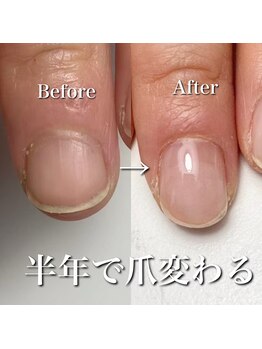 リリー/丸い爪から縦に伸びました！