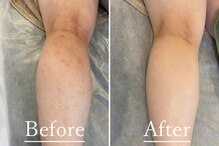 ギンレイ(GINREI)