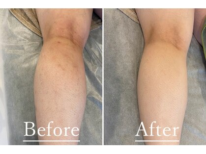 ギンレイ(GINREI)の写真