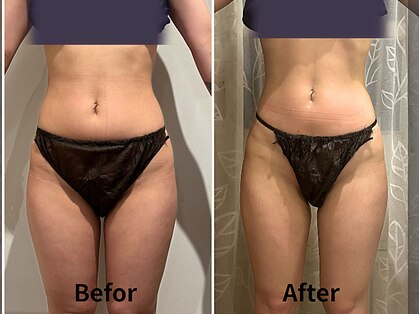 リボーン(boju reborn)の写真